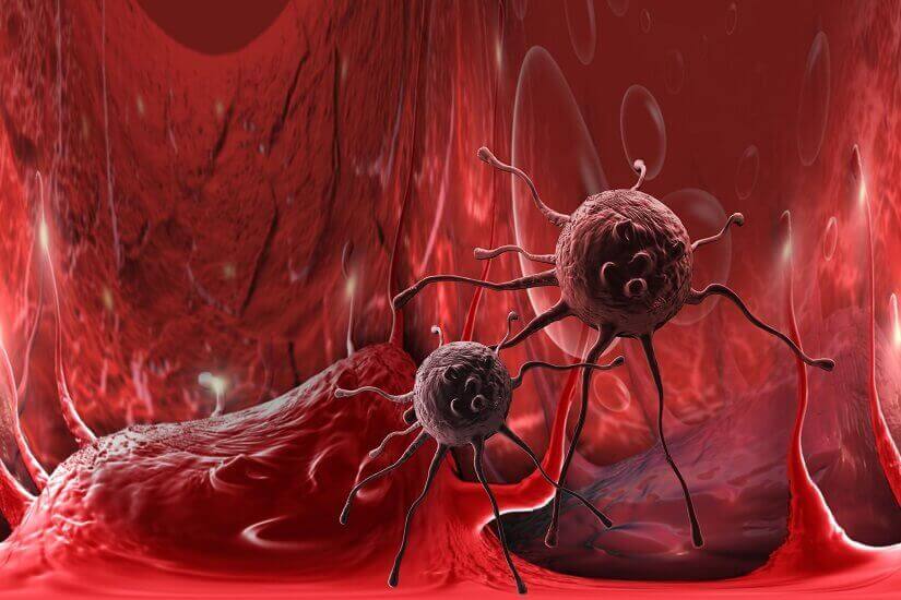 Illustration showing cancer cells within body tissue, representing how cancer develops at a cellular level