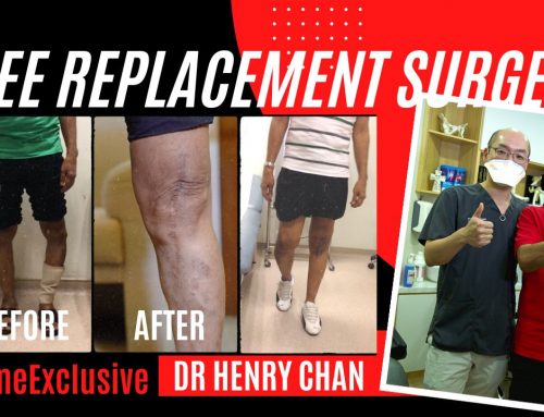 Experience and Thoughts of a Knee Replacement Patient | Dr Henry Chan