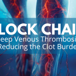 Block Chain Deep Venous Thrombosis - Reducing the Clot Burden with Dr. John Wang
