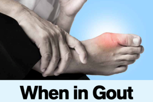 Close-up of a person holding their foot with redness and swelling at the big toe, indicating a gout flare-up.