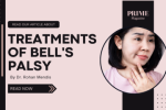 Woman showing signs of Bell’s palsy with facial asymmetry, next to the text “Treatment of Bell’s Palsy”