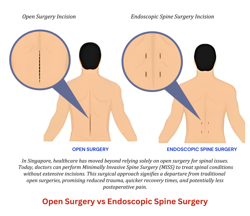 Open Surgery vs Endoscopic Spine Surgery