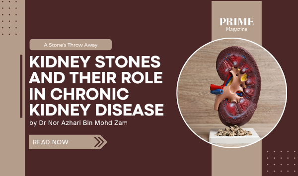 An educational banner from Prime Magazine featuring the title “Kidney Stones and Their Role in Chronic Kidney Disease” by Dr Nor Azhari Bin Mohd Zam, with an anatomical kidney illustration.