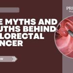 A digital image showing a colonoscopy detecting a polyp inside the colon, representing colorectal cancer screening. Text reads “The Myths and Truths Behind Colorectal Cancer – Prime Magazine.”