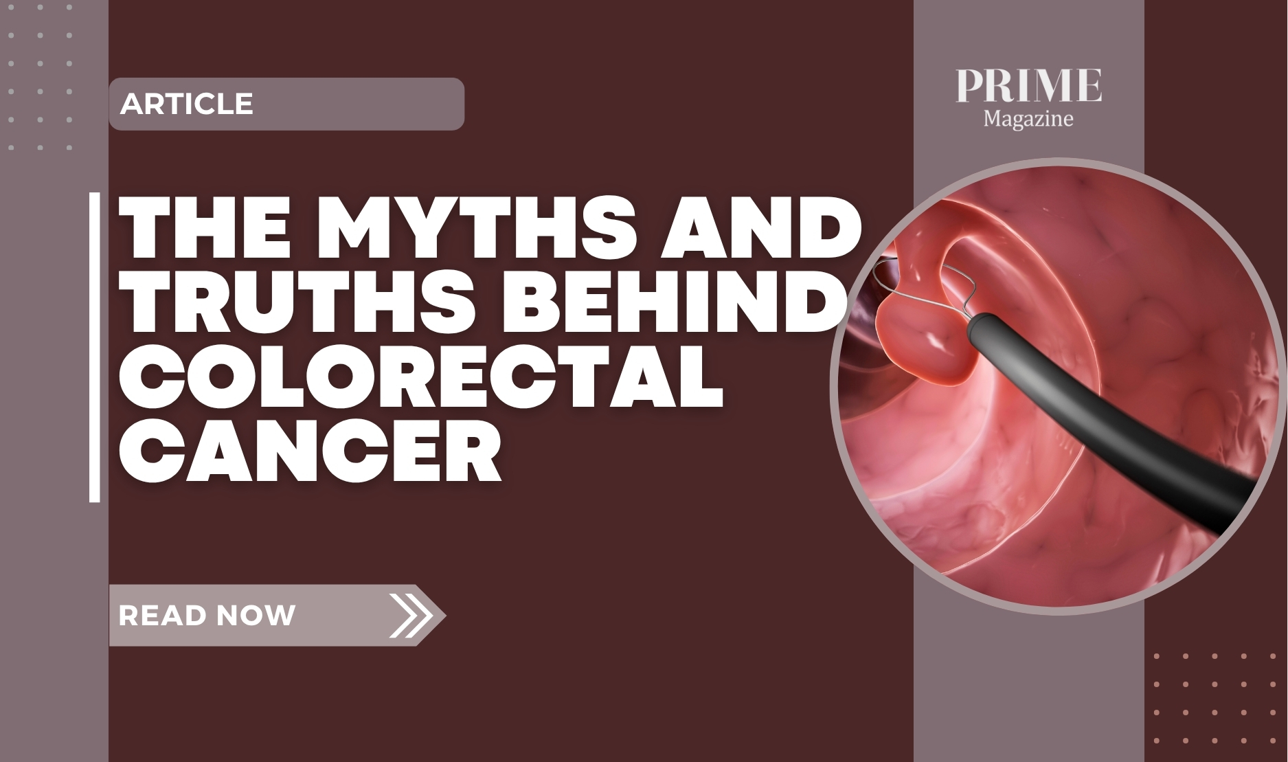 A digital image showing a colonoscopy detecting a polyp inside the colon, representing colorectal cancer screening. Text reads “The Myths and Truths Behind Colorectal Cancer – Prime Magazine.”