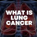 Illustration of human lungs showing highlighted tumour growths with the text “What Is Lung Cancer”.