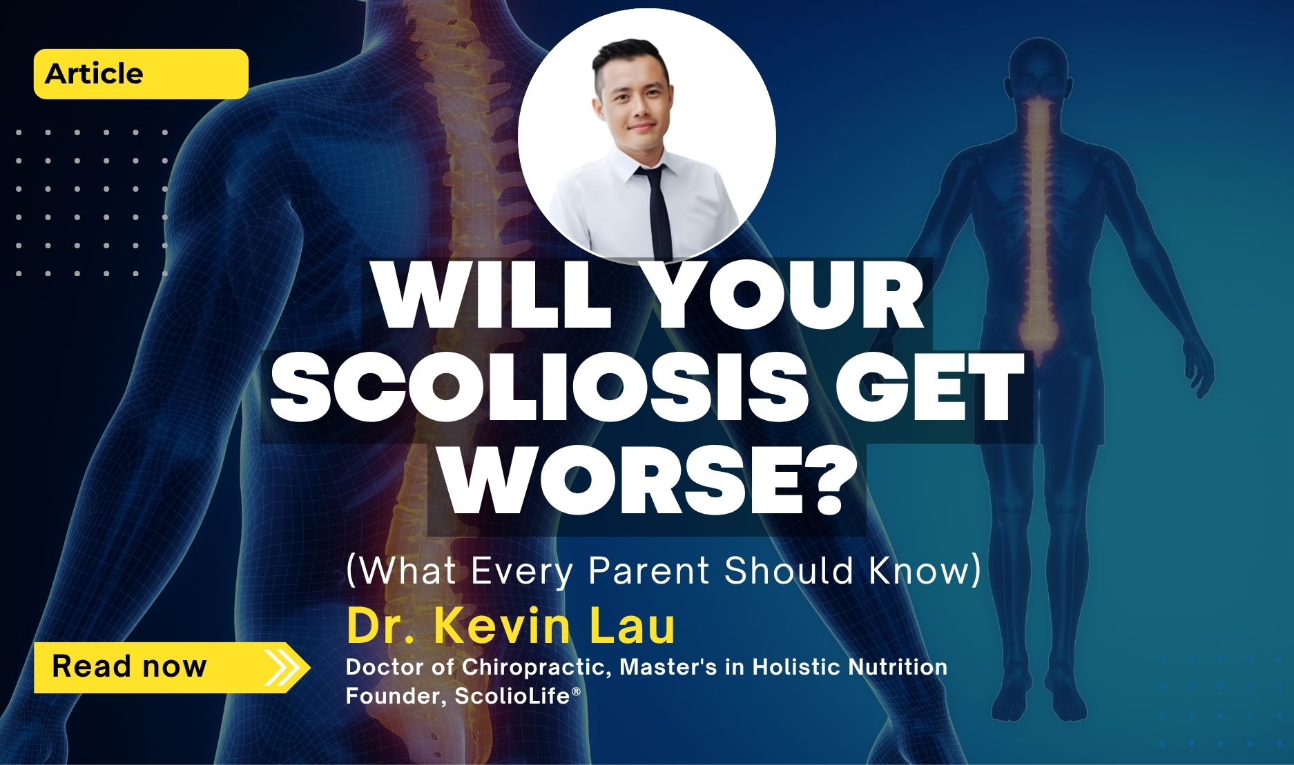 Dr Kevin Lau discussing scoliosis progression and the factors that influence whether spinal curves worsen or remain stable over time.