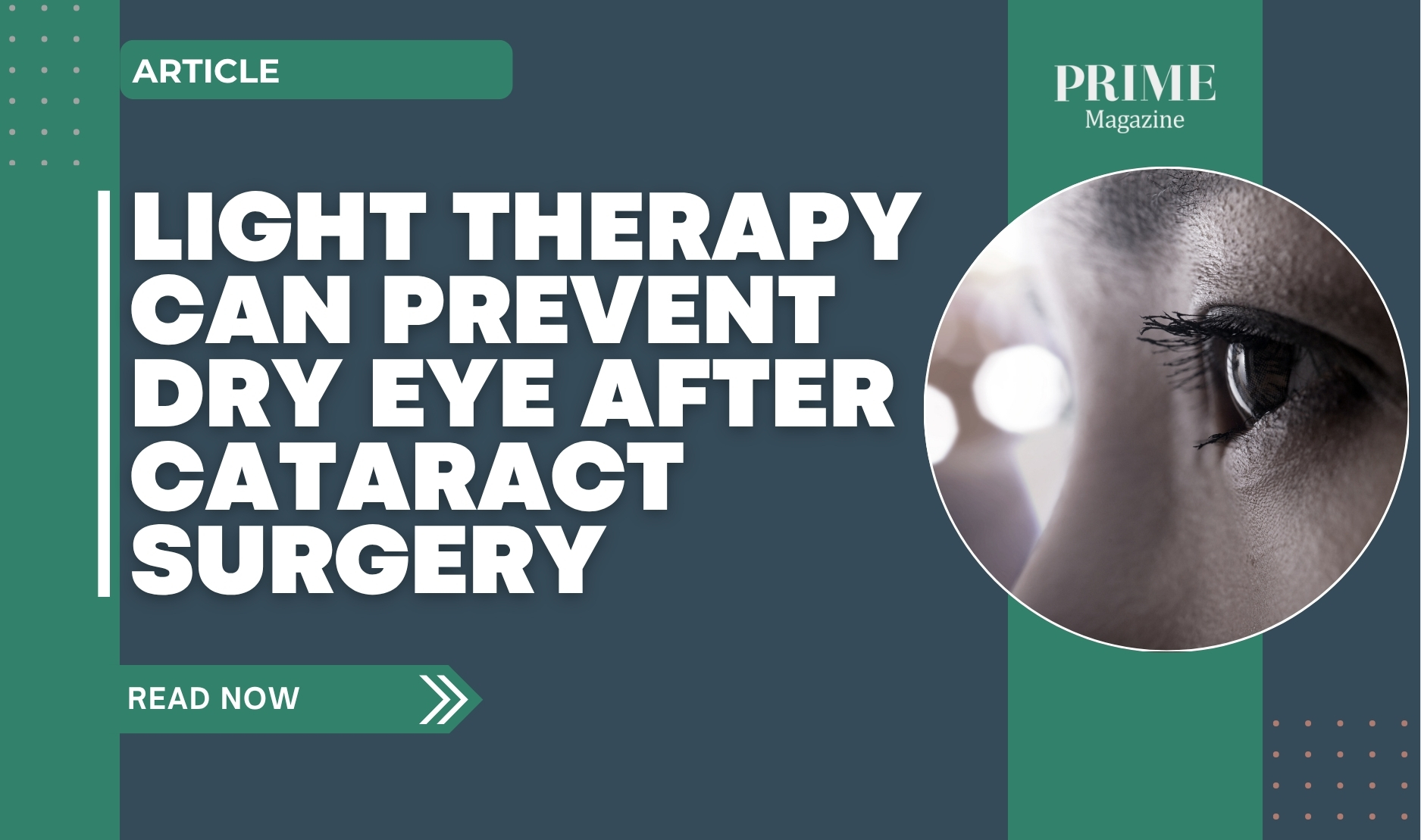 Graphic highlighting how light therapy can prevent dry eye after cataract surgery, featuring a close-up of an eye.