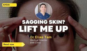 Volformer non-surgical facial lifting treatment for sagging skin by Dr Elias Tam