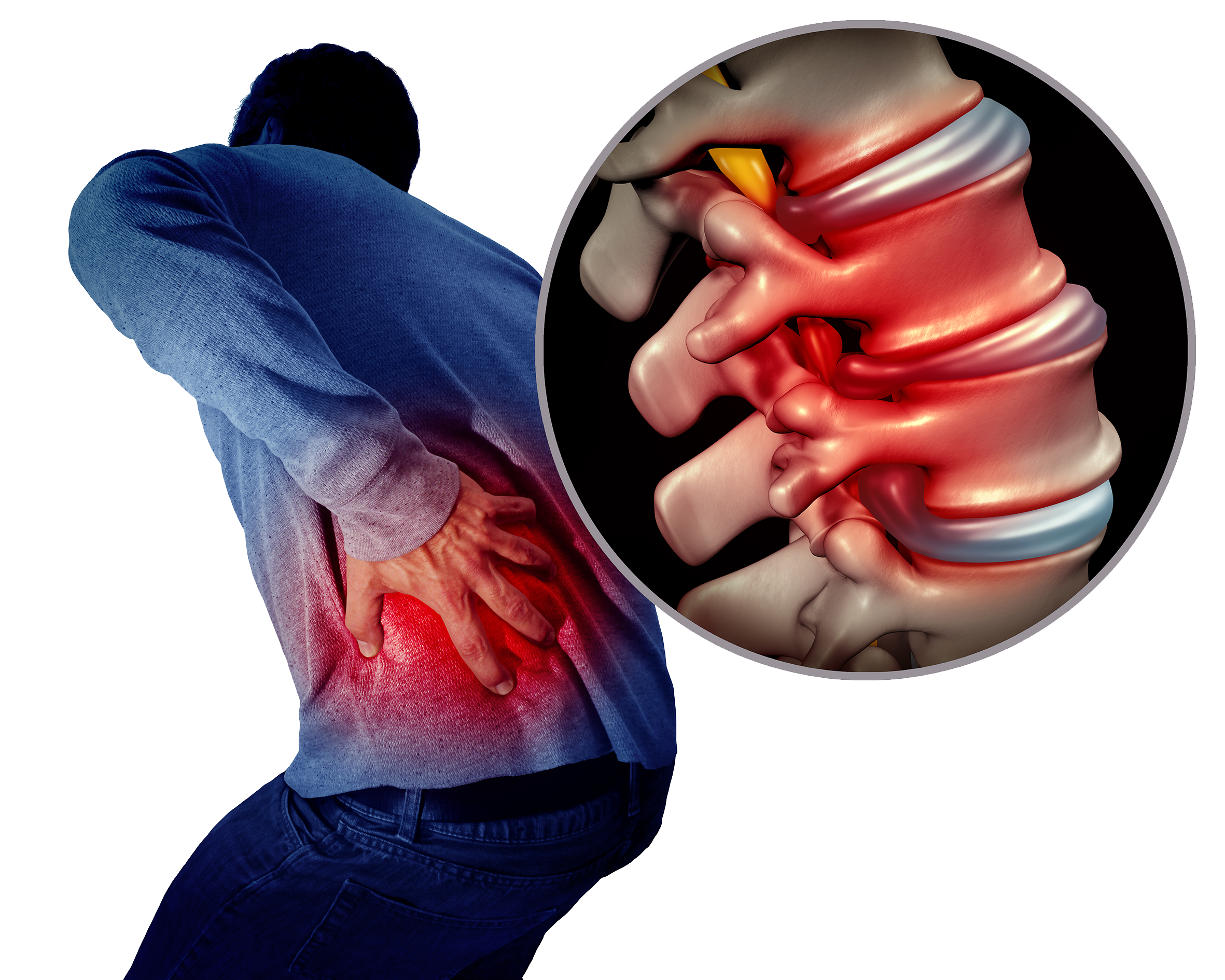 man holding lower back showing sciatica nerve pain caused by compressed spinal disc