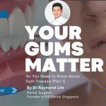 Early signs of gum disease showing inflamed gums and bleeding gums illustration with dental expert Dr Raymond Lim