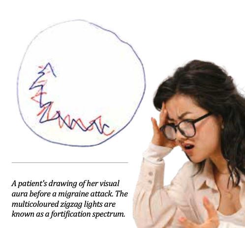 Migraine visual aura illustration