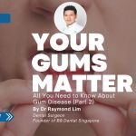 Close-up of a person's mouth showing red, inflamed gums with the article title "Your Gums Matter: All You Need to Know About Gum Disease (Part 2)" by Dr Raymond Lim, featured in Prime Magazine.